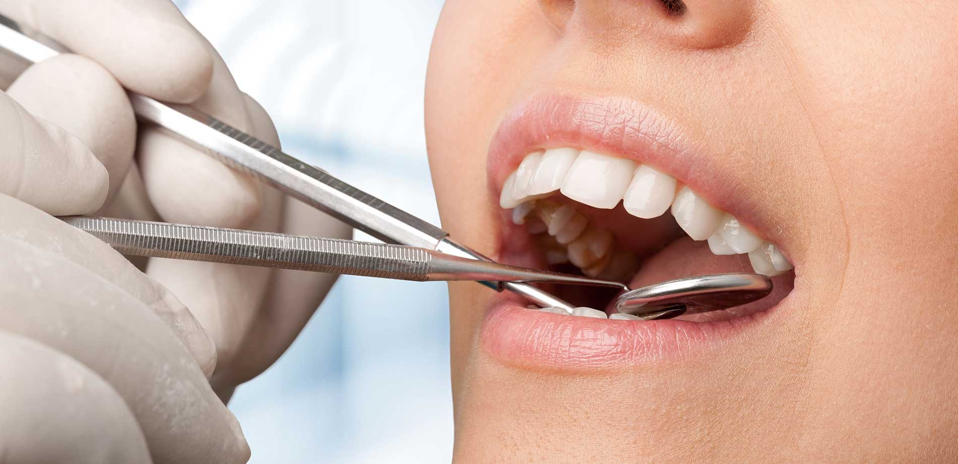 Исследование ротовой полости. Осмотр зубов в стоматологии. Осмотр полости рта у стоматолога.